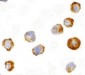 ASK1 Antibody